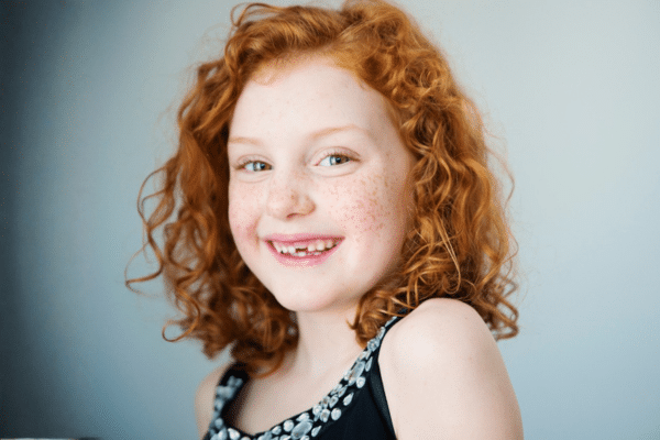 Smiling child patient for early orthodontic treatment at Bernhardt & Smith Orthodontics, Bishop Drive Office and 50th Street Office in West Des Moines, IA